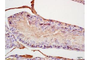 Formalin-fixed and paraffin embedded rat testis labeled with Rabbit Anti FGF8/HBGF-8 Polyclonal Antibody, Unconjugated (ABIN672516) at 1:200 followed by conjugation to the secondary antibody and DAB staining (FGF8 抗体  (AA 131-233))