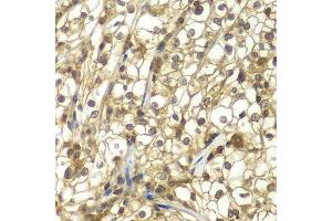 Immunohistochemistry (Paraffin-embedded Sections) (IHC (p)) image for anti-Sulfotransferase Family, Cytosolic, 2B, Member 1 (SULT2B1) (AA 1-365) antibody (ABIN6148720)