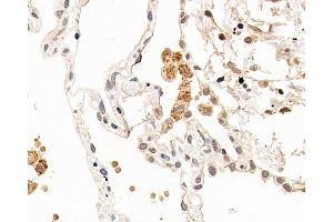 Immunohistochemistry analysis of paraffin-embedded human lung using CXCR7 Polyclonal Antibody at dilution of 1:100. (CXCR7 抗体)