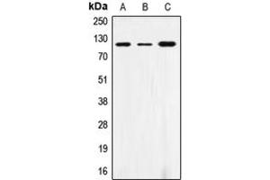 Western blot analysis of CD172a expression in THP1 (A), AML193 (B), HL60 (C) whole cell lysates. (SIRPA 抗体  (C-Term))