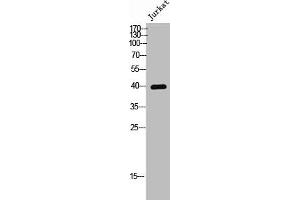 Western Blot analysis of Jurkat cells using Phospho-CKR-5 (S336) Polyclonal Antibody (CCR5 抗体  (pSer336))