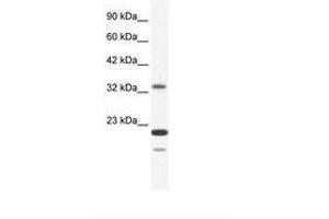 Image no. 1 for anti-Zinc Finger Protein 688 (ZNF688) (AA 95-144) antibody (ABIN203041) (ZNF688 抗体  (AA 95-144))