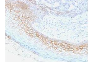 Immunohistochemical staining (Formalin-fixed paraffin-embedded sections) of human skin with DSC2/DSC3 monoclonal antibody, clone 7G6 . (Desmocollin 2 抗体  (Extracellular Domain))