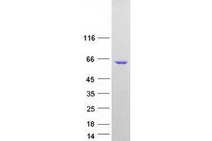 Validation with Western Blot