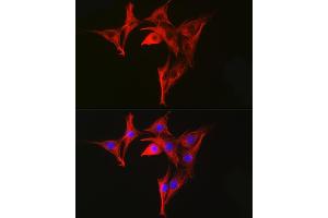 Immunofluorescence analysis of NIH-3T3 cells using α-Tubulin Mouse mAb (ABIN7271035) at dilution of 1:100 (40x lens). (TUBA4A 抗体)