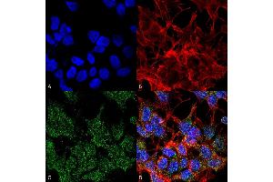 Immunocytochemistry/Immunofluorescence analysis using Mouse Anti-VGLUT2 Monoclonal Antibody, Clone S29-29 . (Solute Carrier Family 17 (Vesicular Glutamate Transporter), Member 6 (SLC17A6) (AA 501-582) 抗体 (Atto 488))