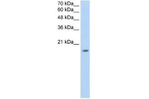 WB Suggested Anti-ZNF580 Antibody Titration:  0. (ZNF580 抗体  (N-Term))