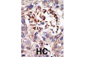 Immunohistochemistry (IHC) image for anti-Chromobox Homolog 8 (CBX8) antibody (ABIN3001538) (CBX8 抗体)
