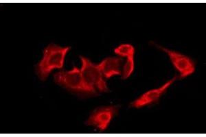 Immunofluorescence (fixed cells) (IF/ICC) image for anti-Cyclin-Dependent Kinase 5, Regulatory Subunit 2 (p39) (CDK5R2) (Internal Region) antibody (ABIN6260714)