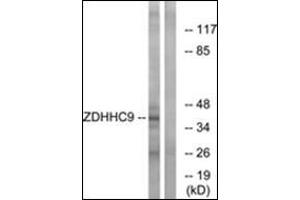 Western Blotting (WB) image for anti-Zinc Finger, DHHC-Type Containing 9 (ZDHHC9) (C-Term) antibody (ABIN1449763)