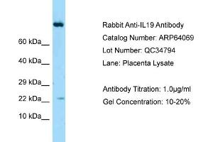 Western Blotting (WB) image for anti-Interleukin 19 (IL19) (Middle Region) antibody (ABIN2789718) (IL-19 抗体  (Middle Region))