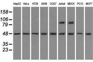 Western blot analysis of extracts (35 µg) from 9 different cell lines by using anti-LEMD3 monoclonal antibody. (LEMD3 抗体)