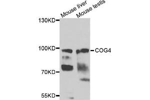 Western blot analysis of extracts of mouse liver and mouse testis cells, using COG4 antibody. (COG4 抗体)