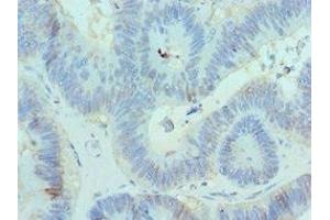 Immunohistochemistry (IHC) image for anti-Chromobox Homolog 8 (CBX8) (AA 80-280) antibody (ABIN7147709)
