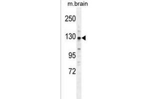 CYLN2 Antibody (C-term) (ABIN1537648 and ABIN2849319) western blot analysis in mouse brain tissue lysates (35 μg/lane). (CLIP2 抗体  (C-Term))
