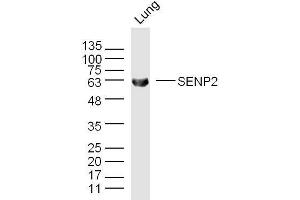 Mouse lung lysates probed with SENP2 Polyclonal Antibody, unconjugated  at 1:300 overnight at 4°C followed by a conjugated secondary antibody for 60 minutes at 37°C. (SENP2 抗体  (AA 1-100))