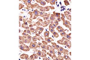 Immunohistochemistry (Paraffin-embedded Sections) (IHC (p)) image for anti-ATP Synthase, H+ Transporting, Mitochondrial F1 Complex, beta Polypeptide (ATP5B) (AA 135-163) antibody (ABIN650786)