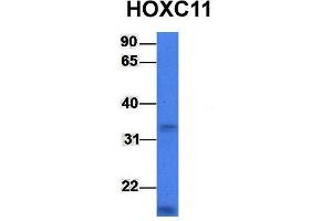 Host:  Rabbit  Target Name:  HOXC11  Sample Type:  721_B  Antibody Dilution:  1. (HOXC11 抗体  (Middle Region))