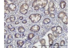 Image no. 2 for anti-Oxidative-Stress Responsive 1 (OXSR1) (AA 1-528) antibody (ABIN599107) (OXSR1 抗体  (AA 1-528))