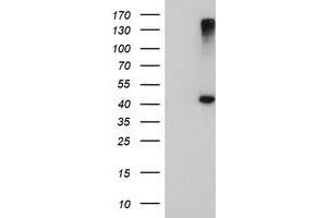 Western Blotting (WB) image for anti-1-Acylglycerol-3-Phosphate O-Acyltransferase 5 (Lysophosphatidic Acid Acyltransferase, Epsilon) (AGPAT5) antibody (ABIN1496497)