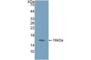 Detection of Recombinant ProGRP, Human using Polyclonal Antibody to Pro-Gastrin Releasing Peptide (ProGRP) (ProGRP 抗体  (AA 54-148))