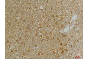 Immunohistochemistry (IHC) analysis of paraffin-embedded Rat Brain Tissue using GABA A Receptor alpha3 Rabbit Polyclonal Antibody diluted at 1:200. (GABRA3 抗体)