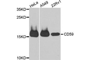 Western blot analysis of extracts of various cell lines, using CD59 antibody. (CD59 抗体)