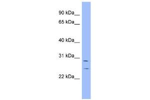 WB Suggested Anti-HEY1 Antibody Titration:  0. (HEY1 抗体  (N-Term))