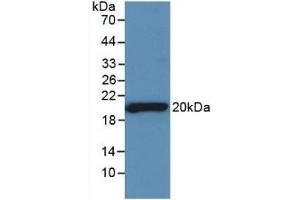 Detection of Recombinant SHBG, Rat using Monoclonal Antibody to Sex Hormone Binding Globulin (SHBG) (SHBG 抗体  (AA 222-358))