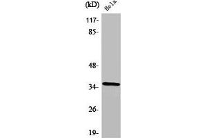 Western Blot analysis of HeLa cells using ZIS Polyclonal Antibody (ZNF265 抗体  (Internal Region))