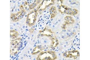 Immunohistochemistry of paraffin-embedded Rat kidney using CDCA8 Polyclonal Antibody at dilution of 1:100 (40x lens). (CDCA8 抗体)