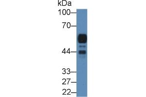 Detection of AMY2A in Rat Pancreas lysate using Polyclonal Antibody to Amylase, Alpha 2A (AMY2A) (AMY2A 抗体  (AA 201-473))
