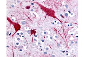 Anti-SLC5A9 antibody IHC of human brain, cortex. (SLC5A9 抗体  (C-Term))