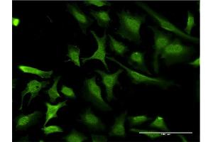Immunofluorescence of monoclonal antibody to RING1 on HeLa cell. (RING1 抗体  (AA 81-170))