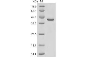 (Tris-Glycine gel) Discontinuous SDS-PAGE (reduced) with 5 % enrichment gel and 15 % separation gel.