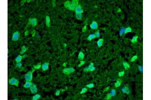 Hsp22, Mouse Spinal Cord (HSPB8 抗体)
