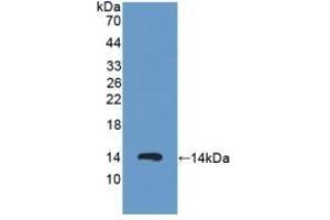 Detection of Recombinant PKIa, Human using Polyclonal Antibody to Protein Kinase Inhibitor Alpha (PKIa) (PKIA 抗体  (AA 13-71))