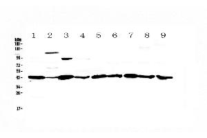 Western blot analysis of Caspase 4 using anti-Caspase 4 antibody . (Caspase 4 抗体  (AA 108-195))