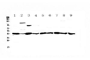 Western blot analysis of Caspase 4 using anti-Caspase 4 antibody .