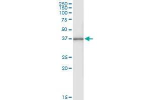 Immunoprecipitation of ACAT2 transfected lysate using anti-ACAT2 MaxPab rabbit polyclonal antibody and Protein A Magnetic Bead , and immunoblotted with ACAT2 purified MaxPab mouse polyclonal antibody (B01P) . (ACAT2 抗体  (AA 1-397))