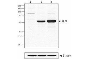 Western Blotting (WB) image for anti-Interferon Regulatory Factor 4 (IRF4) antibody (ABIN2665206) (IRF4 抗体)