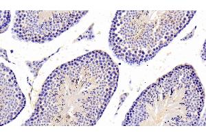 Detection of PTPN5 in Mouse Testis Tissue using Polyclonal Antibody to Protein Tyrosine Phosphatase, Non Receptor Type 5 (PTPN5) (PTPN5 抗体  (AA 270-533))