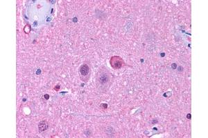 Anti-NPY5R antibody IHC of human brain, neurons and glia. (NPY5R 抗体  (Cytoplasmic Domain))
