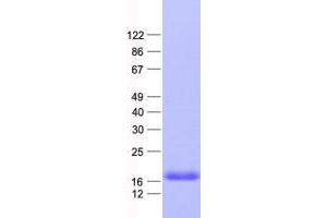 Validation with Western Blot (PLAC8-Like 1 Protein (PLAC8L1) (His tag))