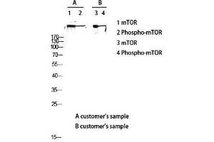 Western Blot (WB) analysis of lysis using Phospho-mTOR (S2448) antibody. (MTOR 抗体  (pSer2448))