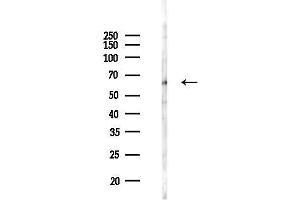 anti-Sequestosome 1 (SQSTM1) (C-Term) antibody