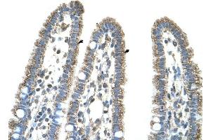 CPS1 antibody was used for immunohistochemistry at a concentration of 4-8 ug/ml to stain Epithelial cells of intestinal villus (arrows) in Human Intestine. (CPS1 抗体  (Middle Region))