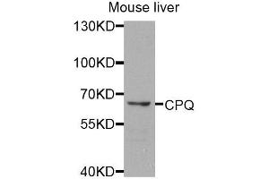 Western blot analysis of extracts of mouse liver, using CPQ antibody (ABIN5974910) at 1/1000 dilution. (CPQ 抗体)