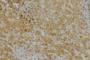 ABIN6272962 at 1/100 staining Mouse liver tissue by IHC-P. (KMO 抗体  (Internal Region))