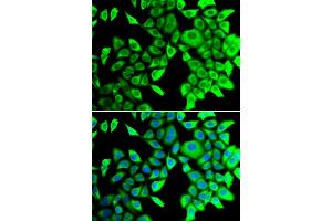 Immunofluorescence analysis of  cells using THADA antibody (ABIN6133115, ABIN6149103, ABIN6149104 and ABIN6222943). (THADA 抗体  (AA 1684-1953))